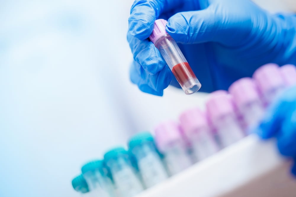 Simple blood test could guide most effective breast cancer treatment