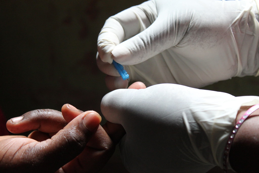 HIV Aid Cuts Threaten Global Progress HIV Aid Cuts Threaten Global Progress